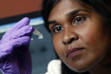 Niña 'curada' de VIH presenta niveles detectables de virus