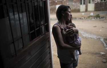 Brasil busca un nexo entre malformaciones y virus del zika