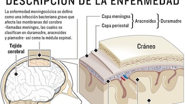 Vacunas para prevenir y erradicar infecciones