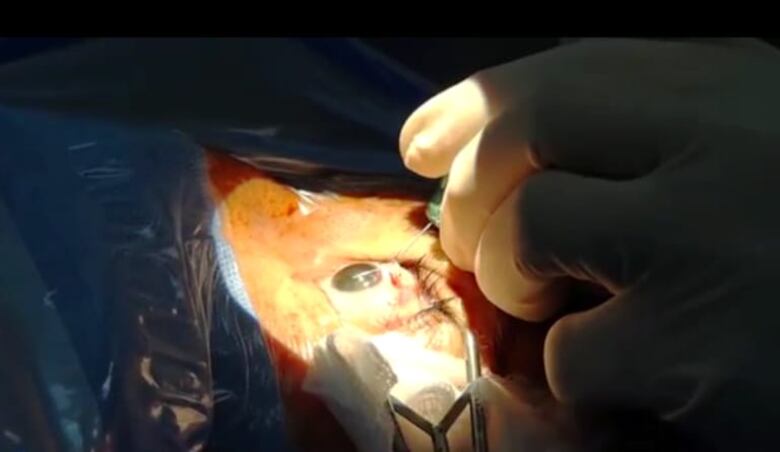 Recuperación quirúrgica: CSS enfrenta el desafío de miles de pacientes en espera