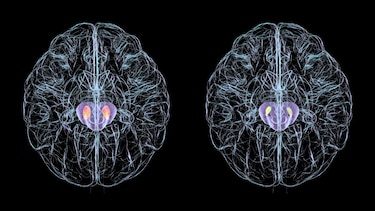 ¿Puede la estimulación tecnológica mejorar el funcionamiento de nuestro cerebro?