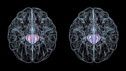 ¿Puede la estimulación tecnológica mejorar el funcionamiento de nuestro cerebro?