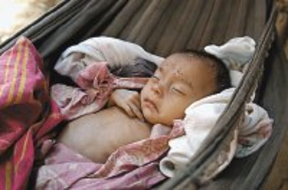 Desnutrición es aterradora en campos y comarcas indígenas