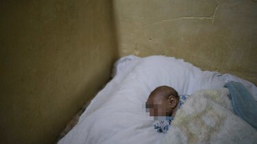 Estudio halla virus del zika en el cerebro de un feto