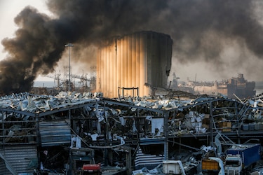 Aumenta balance a 73 muertos y 3 mil 700 heridos por las explosiones en Líbano 