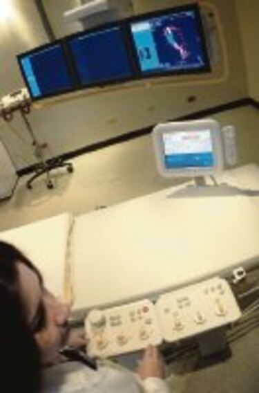 Tumores en el sistema nervioso