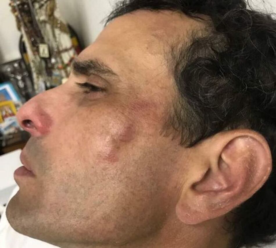 Henrique Capriles afectado por gases durante protesta en Venezuela