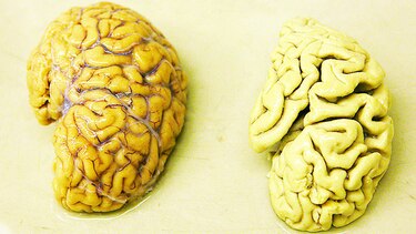 Edad biológica será predecible