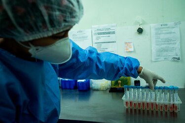La CSS enfrenta escasez de reactivos para pruebas de laboratorio: impacto y causas