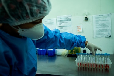 La CSS enfrenta escasez de reactivos para pruebas de laboratorio: impacto y causas