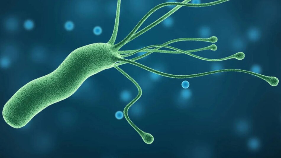 La terapia de rescate para el ‘Helicobacter pylori’ no es del todo efectiva en Europa, según estudio