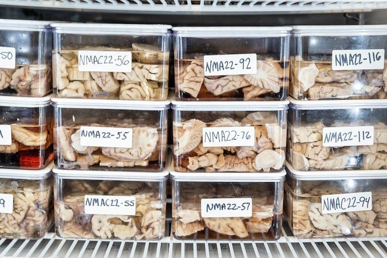 Cómo son los cerebros de los ‘superancianos’