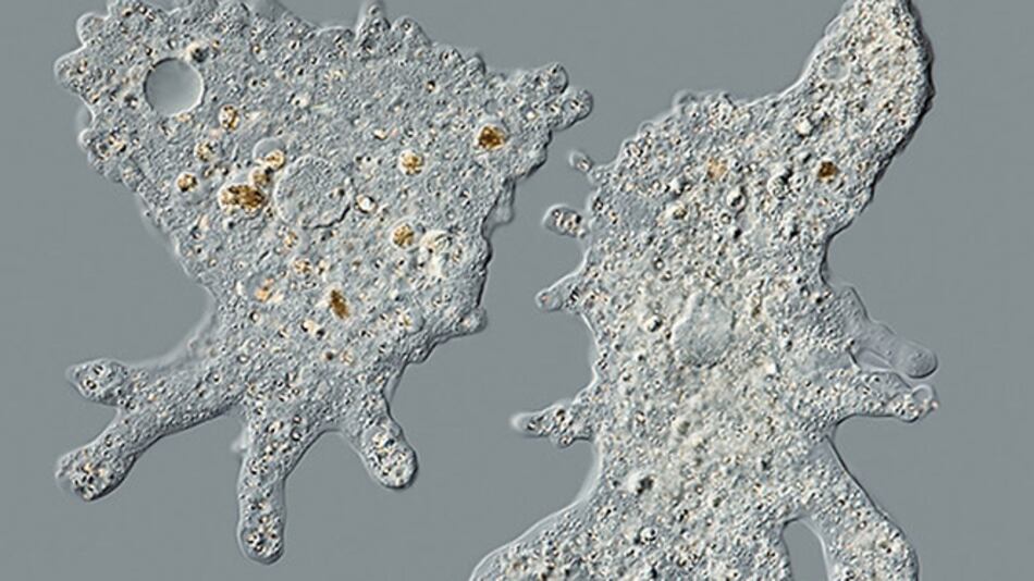 Extraño caso de ameba 'comecerebros' afecta a niño en Perú