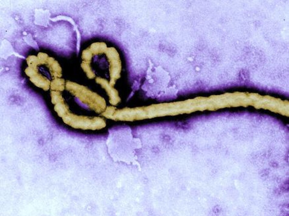 España decidió repatriar al religioso con ébola