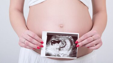 Número de bebés nacidos con VIH en Latinoamérica cayó un 78%