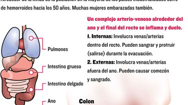 El tabú de una inflamación