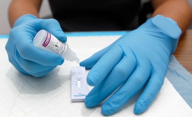 El 44% de los pacientes diagnosticados con VIH en 2025, en Panamá, tenía las defensas debilitadas
