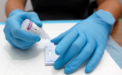 El 44% de los pacientes diagnosticados con VIH en 2025, en Panamá, tenía las defensas debilitadas