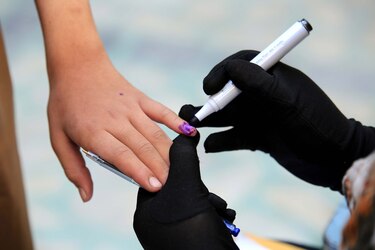 Muere por sarampión un niño no vacunado en Texas en medio de un brote con 124 casos