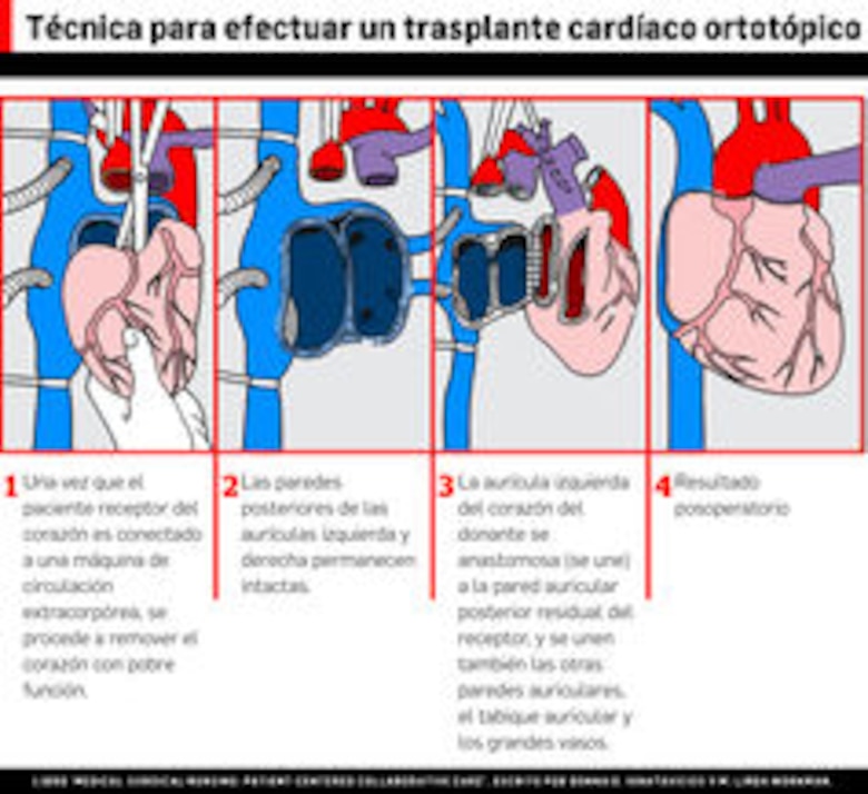 Panamá, segundo país de Centroamérica en practicar trasplante de corazón