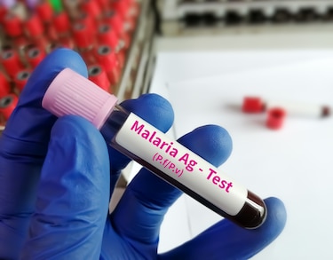 Panamá acumula 3,124 casos de malaria en lo va del año