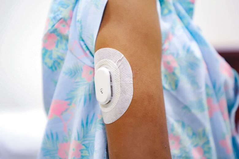 300 niños con diabetes recibirán sensores de monitoreo de glucosa