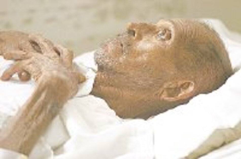 Resultados prometedores