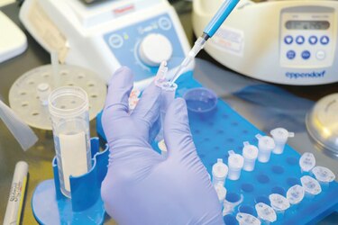 ¿Cómo se confirma un caso de reinfección de Covid-19?