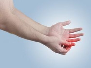 El alcance de la artritis
