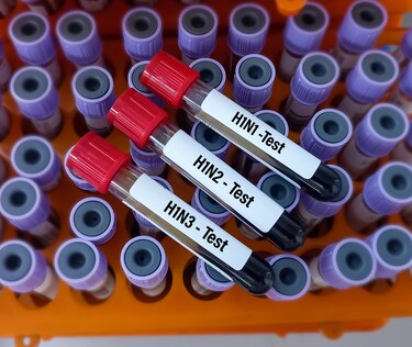 ¿Qué cepas del virus de la influenza están circulando en Panamá?