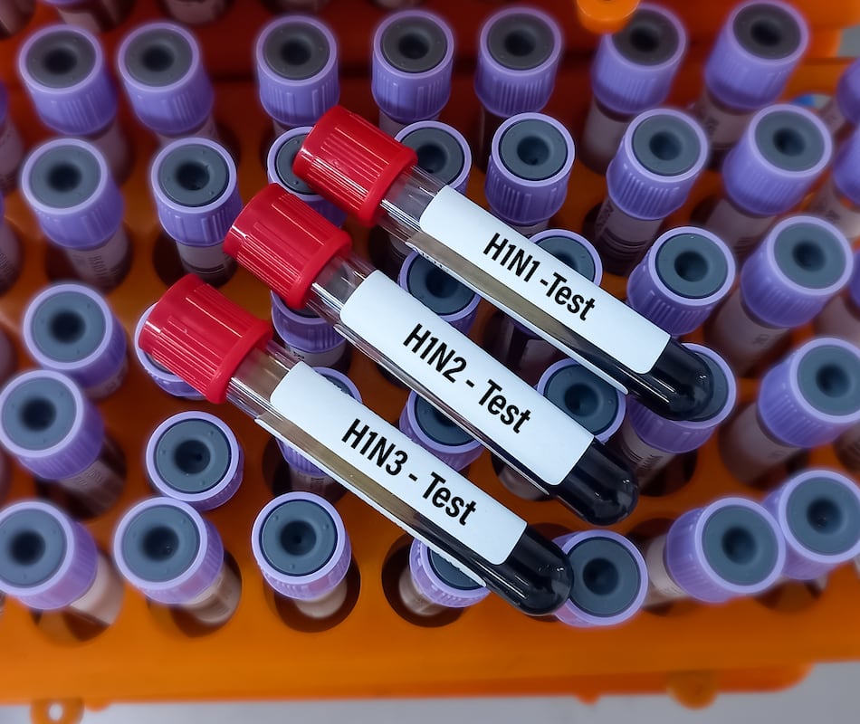 ¿Qué cepas del virus de la influenza están circulando en Panamá?