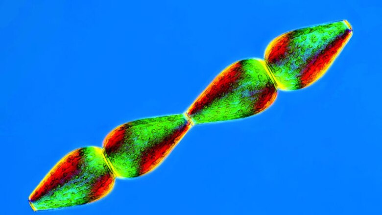 El arte de la fotomicrografía