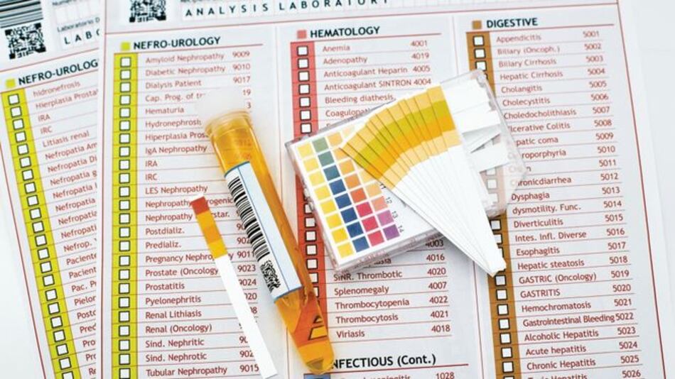 Laboratorio japonés ensayará detección del cáncer con la orina