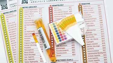 Laboratorio japonés ensayará detección del cáncer con la orina