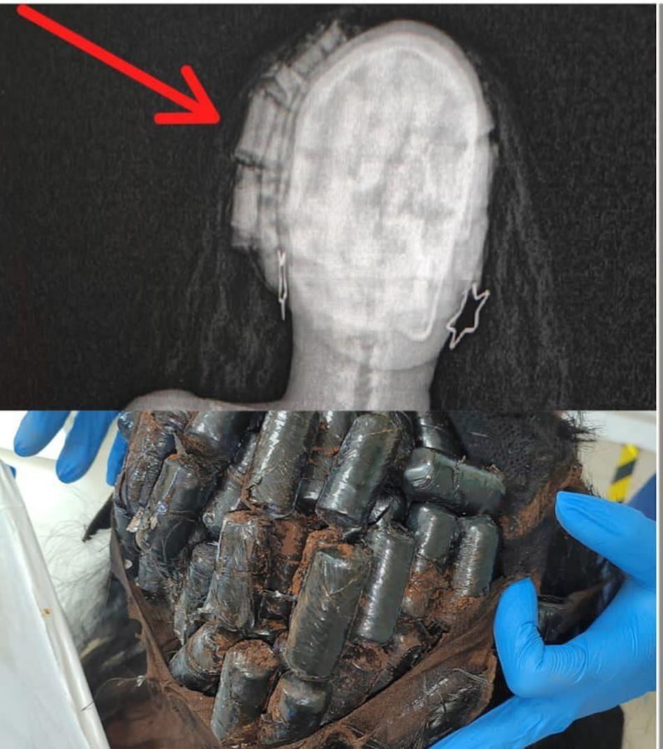 108 meses de prisión para colombiana que transportaba droga en su cabello