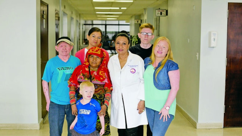 Gaudiano, custodia de la piel albina