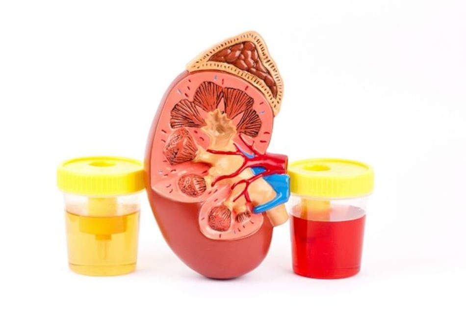 5 mitos de la sangre en la orina (hematuria)