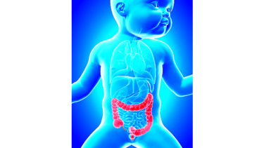 Alternativa contra la desnutrición