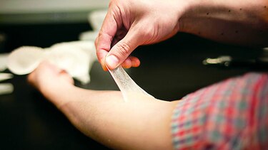 NUEVO MATERIAL CON POTENCIAL DERMATOLÓGICO