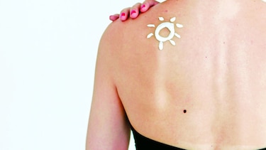 Mayo, un mes para prevenir el cáncer de piel