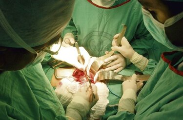 Más pacientes en hemodiálisis que en lista para  trasplante