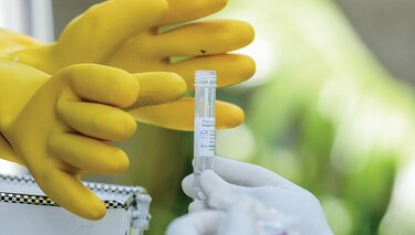 Validación de pruebas serológicas, en las manos del Gorgas