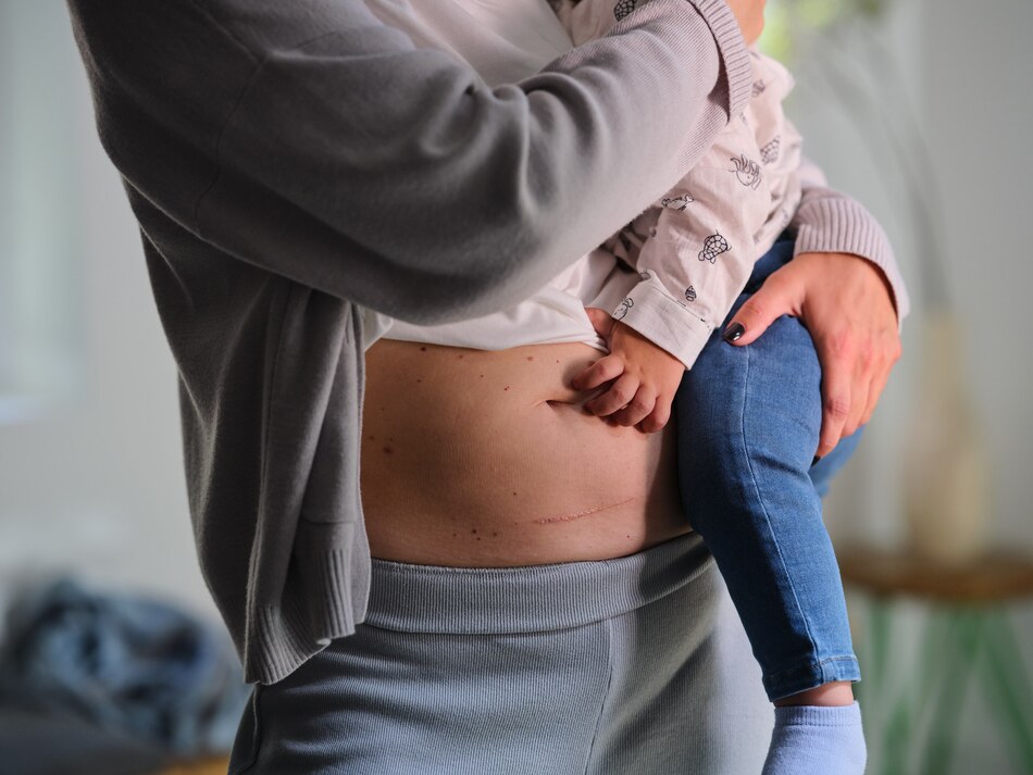 Lo que debes saber sobre la Bifidobacteria