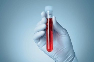 En la sangre podría resolverse el misterio del cáncer, a futuro