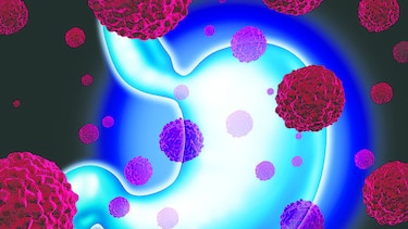 La presencia del cáncer gástrico