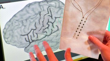 Prótesis controlada por ondas cerebrales