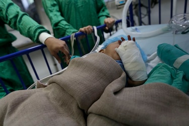 Bombitas, cebollitas y ‘mata suegra’, pirotecnia que causa quemaduras en los niños
