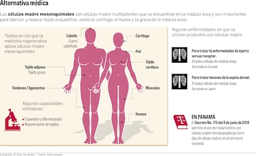 Ensayo preclínico de células madre para tratar SARS-CoV-2