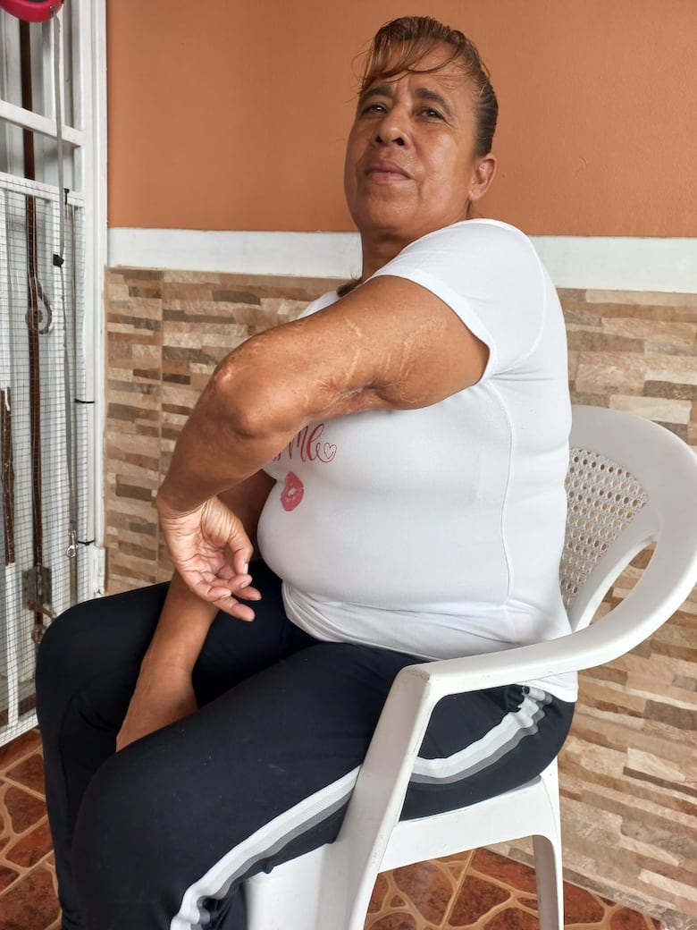 27 víctimas de accidentes con metrobuses reclaman indemnización, tras 13 años de espera