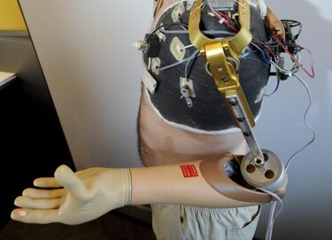 Mujer paralítica controla brazo robótico con la mente